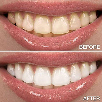 XL (1) Teeth Whitening Pen 4cc (not 2cc) of 22% Carbamide Peroxide Tooth Whitener Stain Remover Gel. Natural Mint, no Sensitivity, Made in The USA.