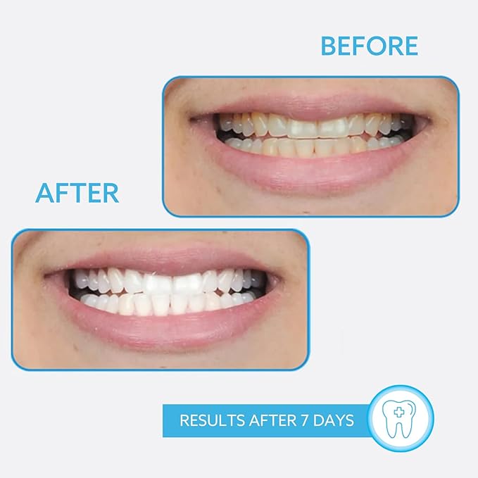 GO Smile On the Go Teeth Whitening Pen 1.3mL, Portable Whitener & Stain Remover, Whitening Strips Alternative, Quick Dry Brush Applicator, Travel Size Oral Care Gift for Women & Men, Mint, Pack of 1