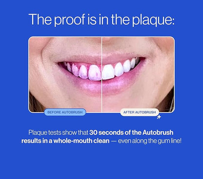 Autobrush Sonic Pro Electric Toothbrush – Only ADA Accepted U-Shaped Brush, Clinically Proven Up to 5.1X Better Cleaning, 30-Second Full Mouth 360 Clean, Rechargeable, Waterproof, Black, Men's Regular