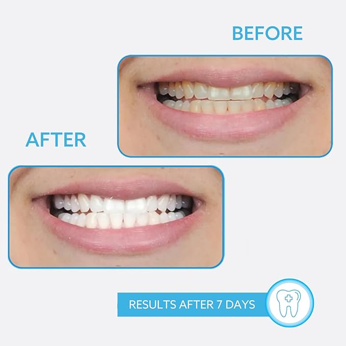 GO SMILE On the Go Teeth Whitening Pen 1.3mL, Portable Whitener & Stain Remover, Whitening Strips Alternative, Quick Dry Brush Applicator, Travel Size Oral Care Gift for Women & Men, Mint, Pack of 2