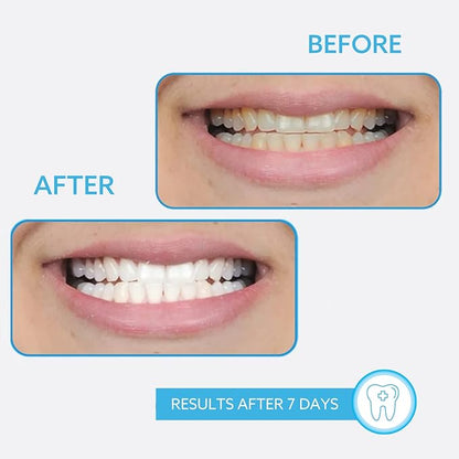 GO SMILE On the Go Teeth Whitening Pen 1.3mL, Portable Whitener & Stain Remover, Whitening Strips Alternative, Quick Dry Brush Applicator, Travel Size Oral Care Gift for Women & Men, Mint, Pack of 2
