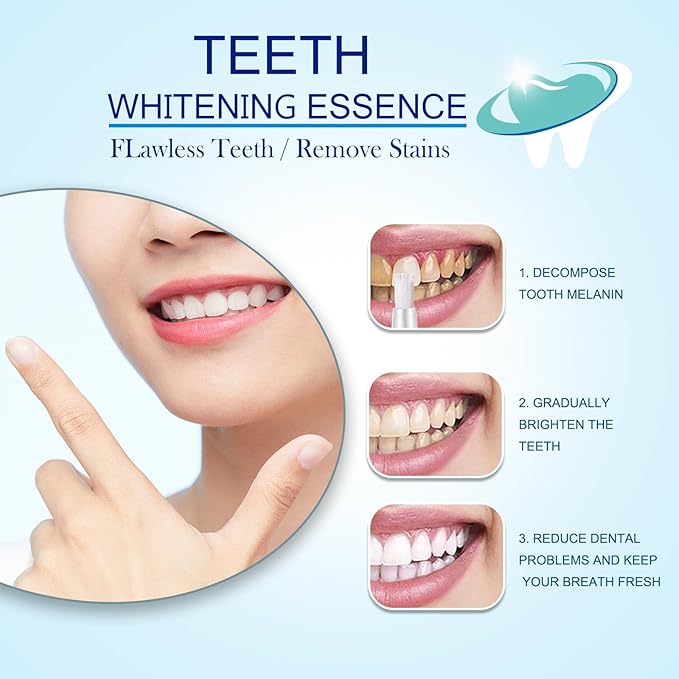 Extra Strength Instant Results Teeth Whitening Pen for Adults, Power Swabs for Teeth as Seen on TV, in Between Teeth Stain Remover, Teeth Whitening Pen for Pets, Freshens Breath (4)