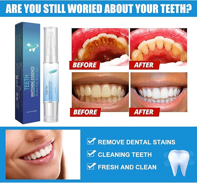 Extra Strength Instant Results Teeth Whitening Pen for Adults, Power Swabs for Teeth as Seen on TV, in Between Teeth Stain Remover, Teeth Whitening Pen for Pets, Freshens Breath (4)