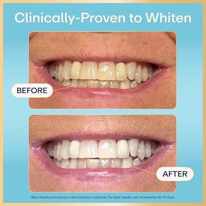 Lumineux 2-in-1 Whitening Pen (2 Pack) Enamel Safe and Clinically Proven to Whiten Without The Sensitivity - Removes Coffee, Tea, and Smoking Stains