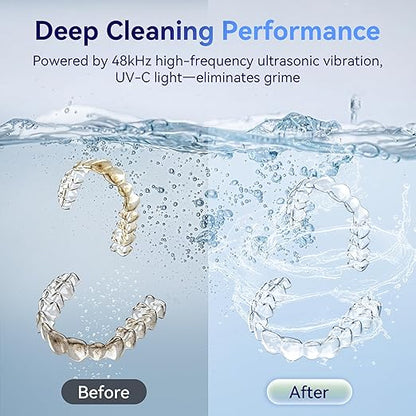 Ultrasonic Retainer Cleaner Machine 48kHz, Dental Cleaning Pod, Ultrasonic Retainer Cleaner for Dentures, Aligners, Mouth Guards, Toothbrush Heads and Jewelry with 200ML Capacity, LAB Supply