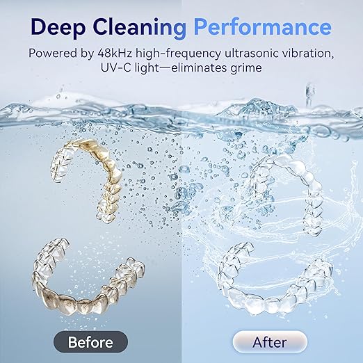 Ultrasonic Retainer Cleaner Machine 48kHz, Dental Cleaning Pod, Ultrasonic Retainer Cleaner for Dentures, Aligners, Mouth Guards, Toothbrush Heads and Jewelry with 200ML Capacity, LAB Supply