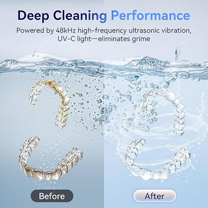 Ultrasonic Retainer Cleaner Machine 48kHz, Dental Cleaning Pod, Ultrasonic Retainer Cleaner for Dentures, Aligners, Mouth Guards, Toothbrush Heads and Jewelry with 200ML Capacity, LAB Supply