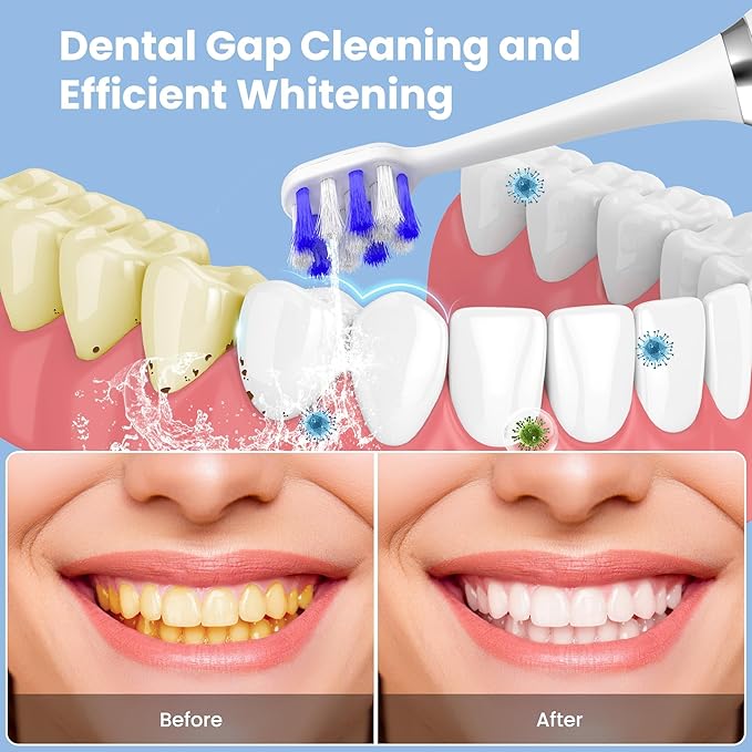 Electric Toothbrush with Water flosser, 2 in 1 Teeth Cleaning Kit, Toothbrush and Water flosser Combo, 25 - Day Battery, Travel Toothbrush with Water Bottle(White)