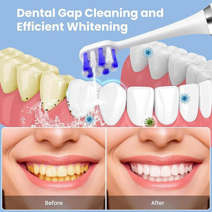 Electric Toothbrush with Water flosser, 2 in 1 Teeth Cleaning Kit, Toothbrush and Water flosser Combo, 25 - Day Battery, Travel Toothbrush with Water Bottle(White)